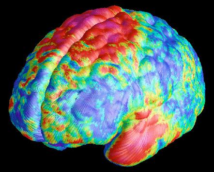 Colored brain